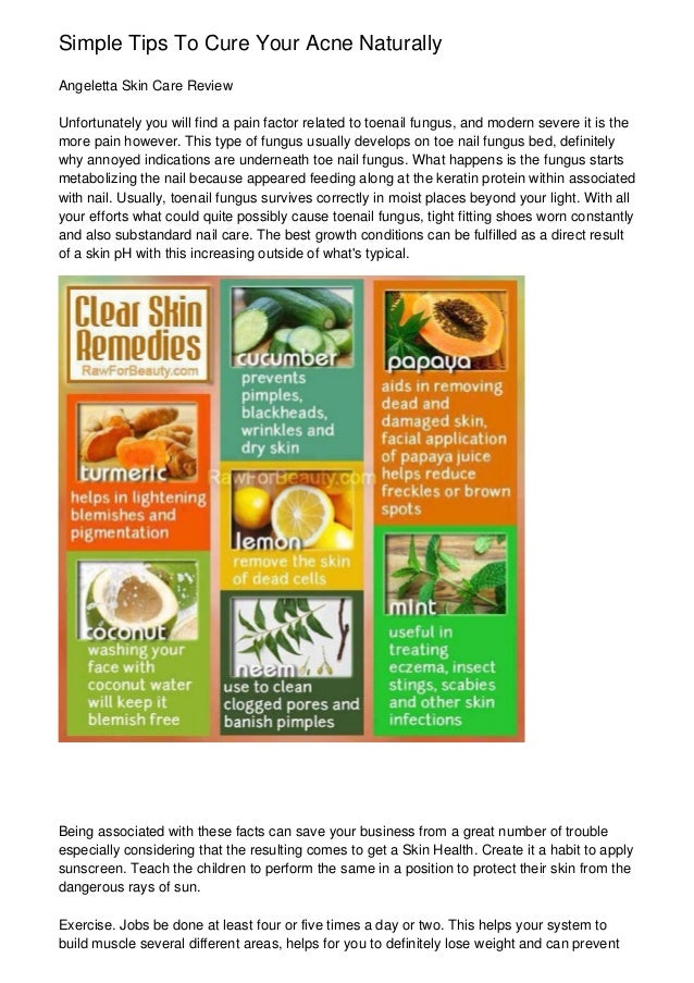 Simple Health Tips For Natural Cures (SERIES ONE)
